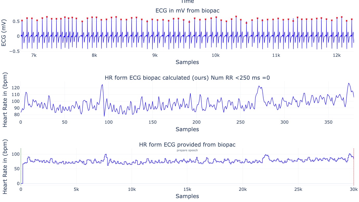 Multi-panel biosignal output: an ECG trace in millivolts with detected R-peaks marked, the heart rate derived from those intervals, and the reference heart rate reported by the acquisition system for comparison.